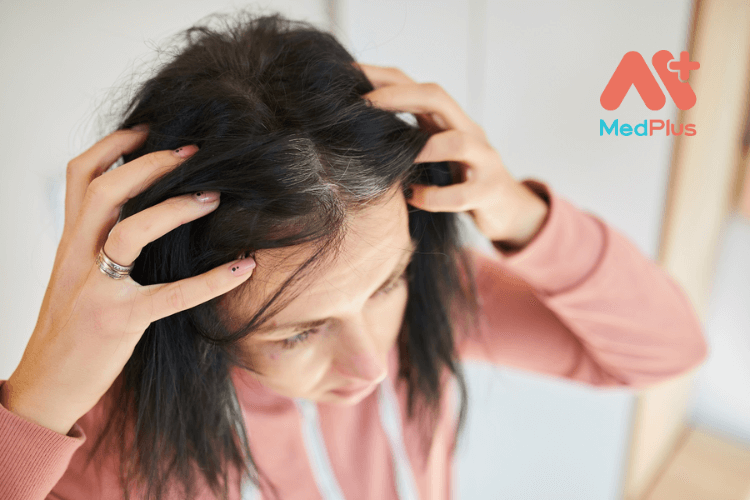Nấm da đầu gây ngứa ngáy khó chịu, ảnh hưởng đến sức khỏe và cuộc sống người bệnh