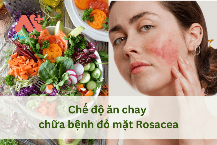 Chế độ ăn chay cung cấp nhiều chất dinh dưỡng lợi cho sức khỏe làn da, hỗ trợ điều trị bệnh đỏ mặt Rosacea